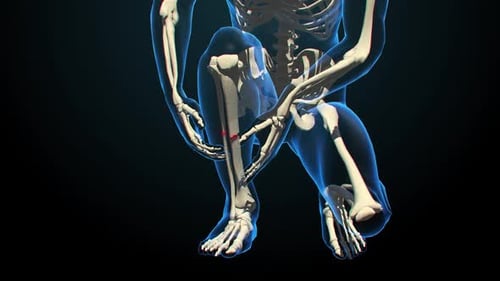 Animated Human Skeleton Leg Fracture Medical Anatomy
