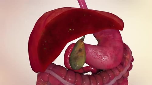 3D Animation of Gallstone Removal from the Liver and Bile Duct