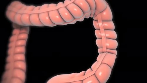 Animated 3D Human Colon with Internal Medical Procedure