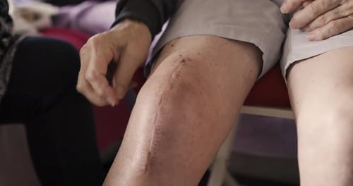 Knee Scar After Surgery Close Up