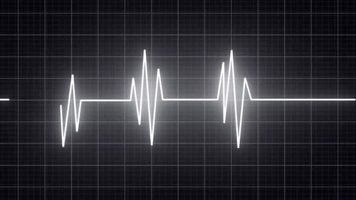 Heartbeat