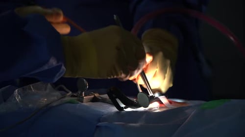 Surgical Procedure with Gloved Hands and Instruments