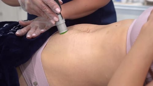 Alexandrite Laser in Aesthetic Medicine Woman on Laser Hair Removal Treatments Belly Area Beautician