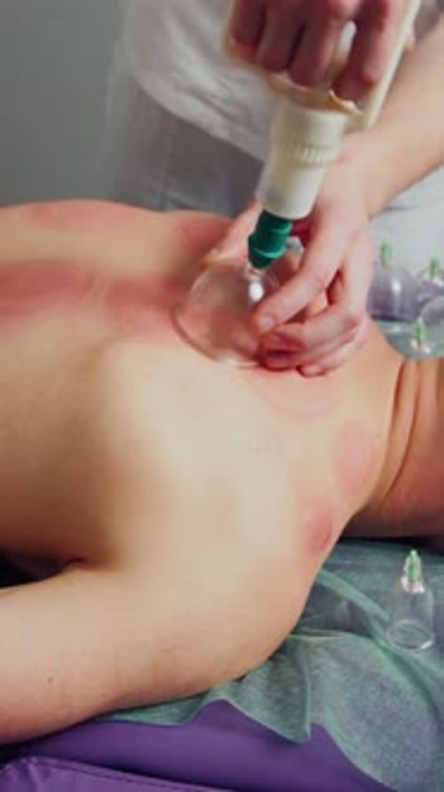 Cosmetic Body Massage with a Jar Glass Massage Spa Therapy Cupping Therapy Alternative Medicine