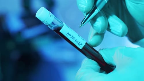 Gloved Hands Marking Blood Sample Test Tube