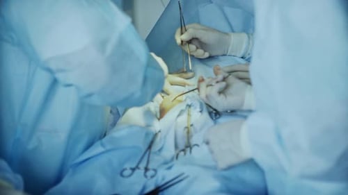 Closeup of Surgical Teamwork