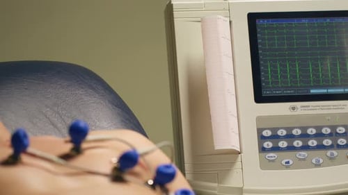 Electrocardiogram Test in Progress