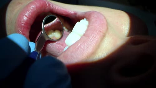 Dental Care Extreme Close Up Macro Video Dentist Treat Patient Teeth Orthodontist Works with