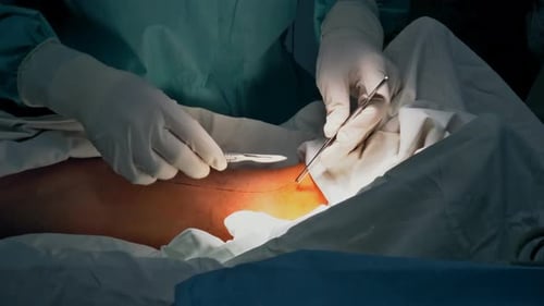 Surgeon Performing Incision With Scalpel During Procedure