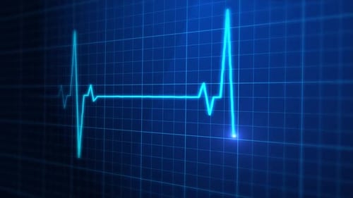 Medizinische EKG-Pulsmesseranzeige