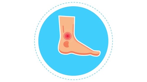 Animated Human Foot with Ankle Pain Icon