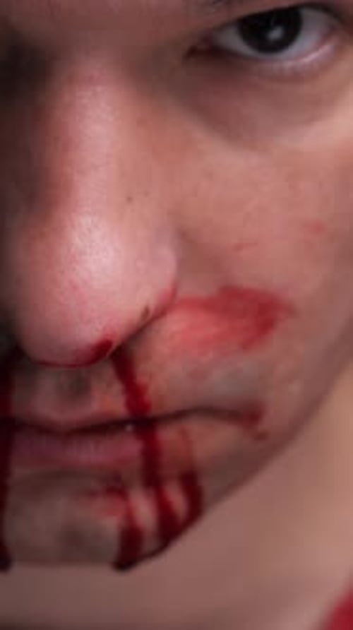 Man's Face Covered in Blood From Injury