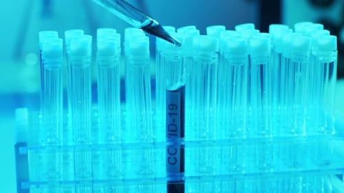 Laboratory Tubes with Blood and Virus Closeup of Scientific Lab in Hospital Epidemic Disease