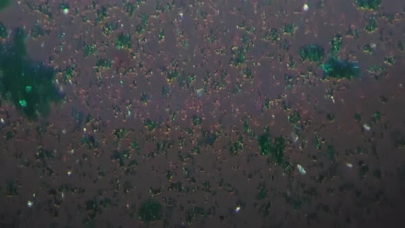Microzyme Whole Mount Under Microscope 200x Filmed with Cross Light ...