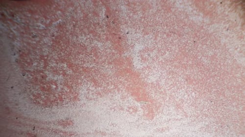 Fresh blood seen on a 100x microscope view. Blood smear under microscope present plasma