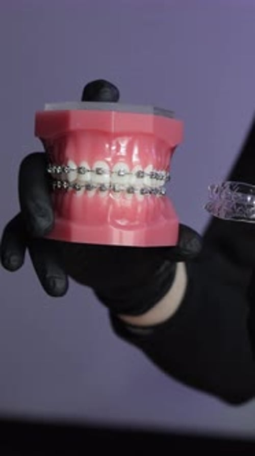 Orthodontist Comparing Metal Braces and Clear Aligners
