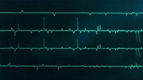 Neon Futuristic ECG Heartbeat Monitor Waveform Animation