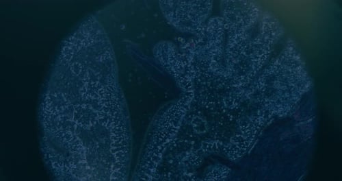 Cancer Cells Under Microscope At Laboratory