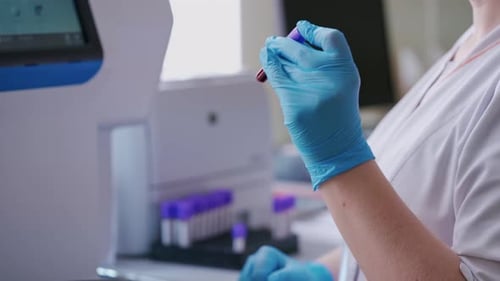 Close up of hands holding tube. Doctor holding vacuum blood collection tube with blood sample