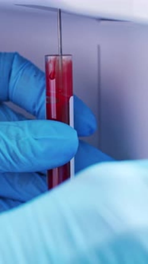 Medical Professional Holds Blood Sample in Test Tube