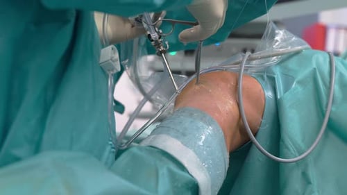 Surgeon Performing Surgery on Patient's Knee