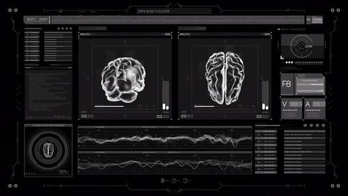 Futuristic Medical Brain Scan Data Analysis HUD Display