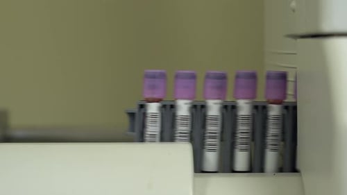 Blood Vials Loading Into Laboratory Machine