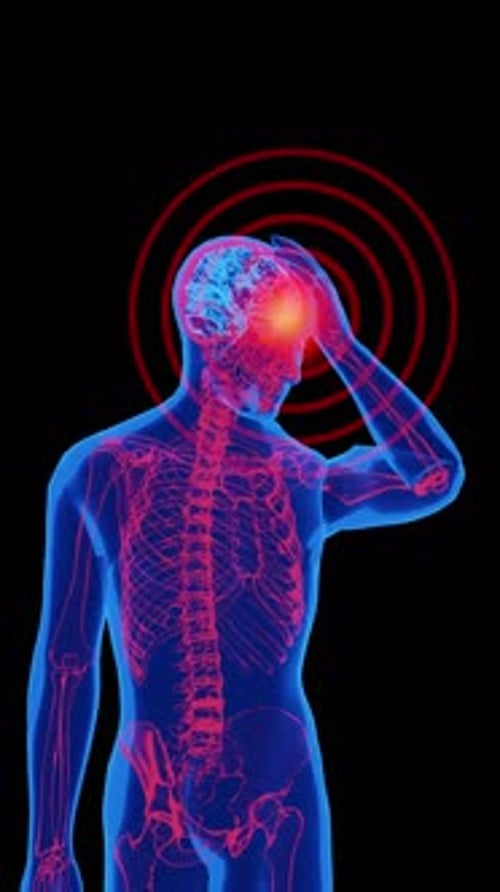 Illustration of headache in human anatomy portrait