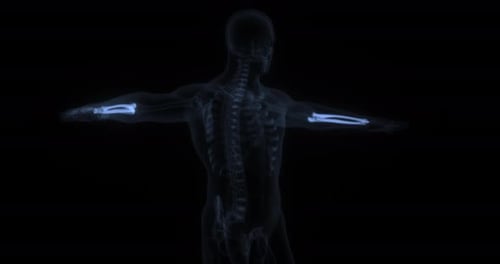 Futuristic Medical Scan of Human Arm Bones