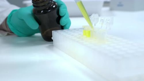 Laboratory Worker in Gloves Does Scientific Urine Test