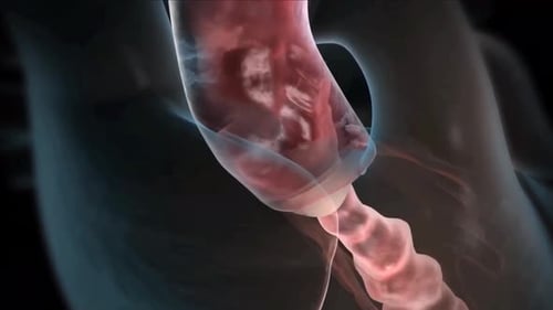 3D Peristalsis Animation of Human Esophagus and Stomach