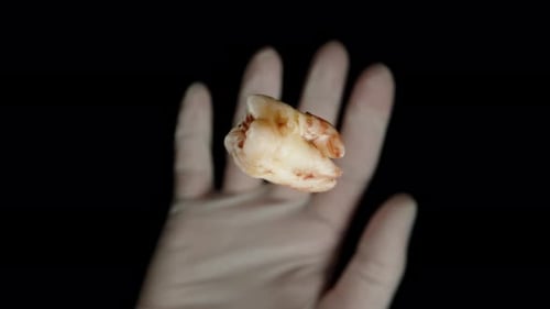 Knocked-out Human Tooth Spins and Falls Down, Caught by a Hand in a White Glove, Macro Super Slow