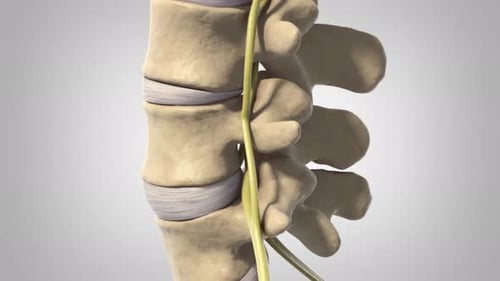 Herniated Disc Compressing Sciatic Nerve 3D Medical Animation