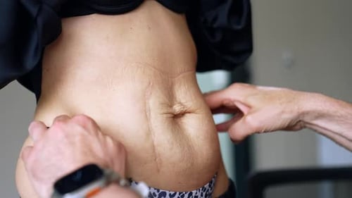 Les mains des hommes touchent le ventre de la femme avec une peau lâche et ridée.
