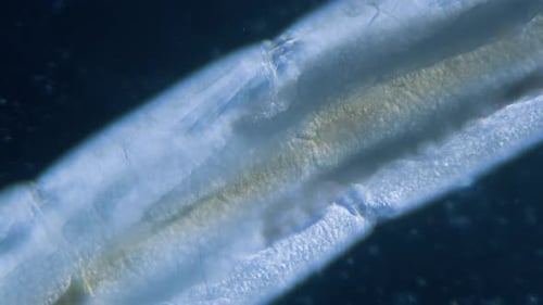 Ceratopogonidae-Stechmücklarvenstadium im Wasser unter dem Mikroskop