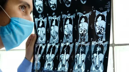 female doctor analysing abdomen tomogrpahy. ct scan.