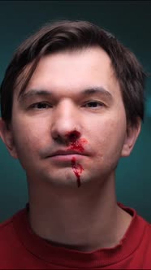 Close-Up of Man with Bloody Nose
