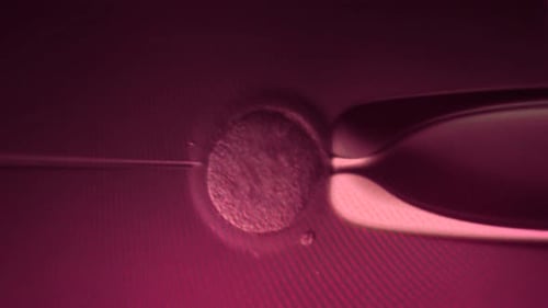 IVF in vitro fertilization through a microscope. Intracytoplasmic sperm injection