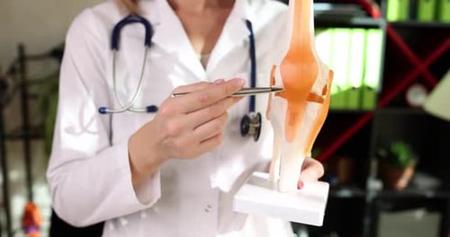 Doctor shows anatomy of structure of human knee joint in clinic