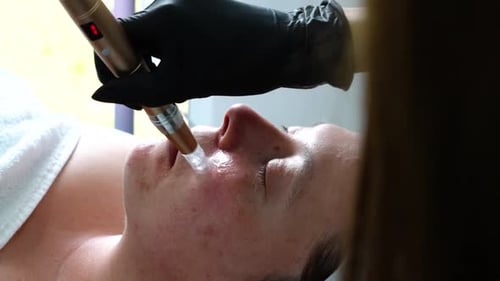 Innovative Skin Rejuvenation: Microneedling Facial Treatment for Enhanced Glow and Youthful Appearan