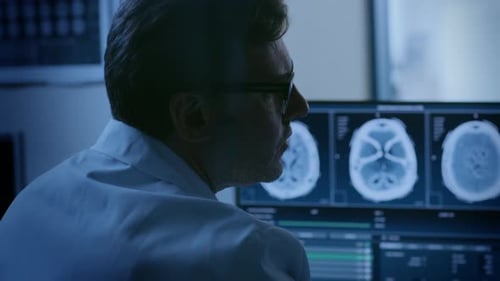 Doctors Reviewing Brain Scans on Multiple Computer Screens