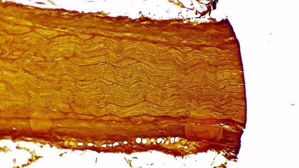 Silvering Pattern of Human Nerves Trunk in Longitudinal Section Under ...