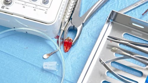 Extracted Tooth Held in Dental Pliers Close Up