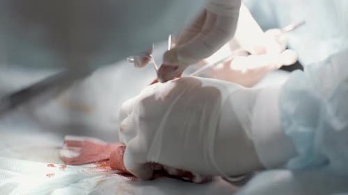 Close Up of Surgical Tools Used During a Medical Procedure