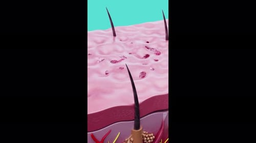3D Human Skin Layers with Spreading Skin Disease Animation