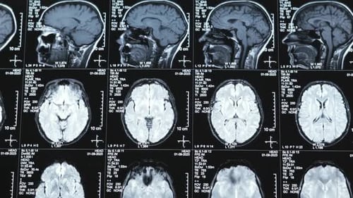 Image Of Human Brain
