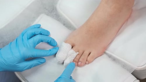 Foot with Bandaged Toes Being Treated