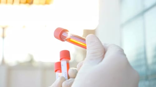 Medical Test Tubes Close Up with Liquid