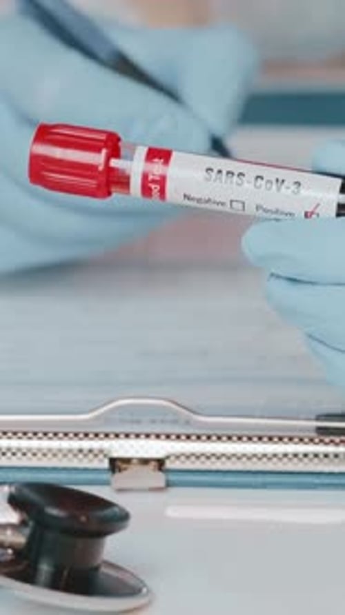 Medical Professional Marks Positive Virus Blood Test