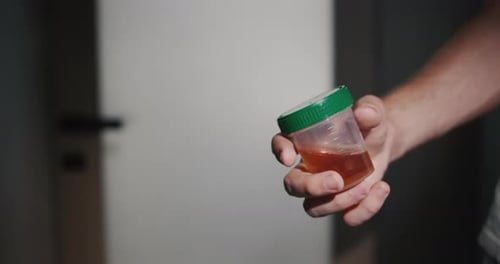Um homem está na porta do banheiro com um frasco para exames de urina